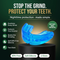 Somnora Mouth Guard